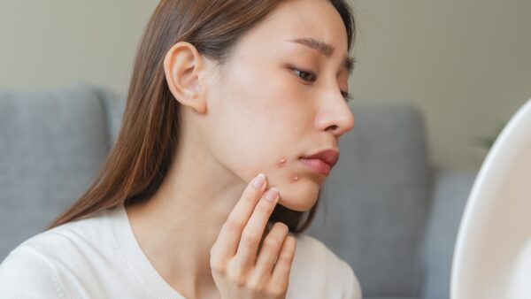 脱毛後に白いブツブツができた…対処法を解説